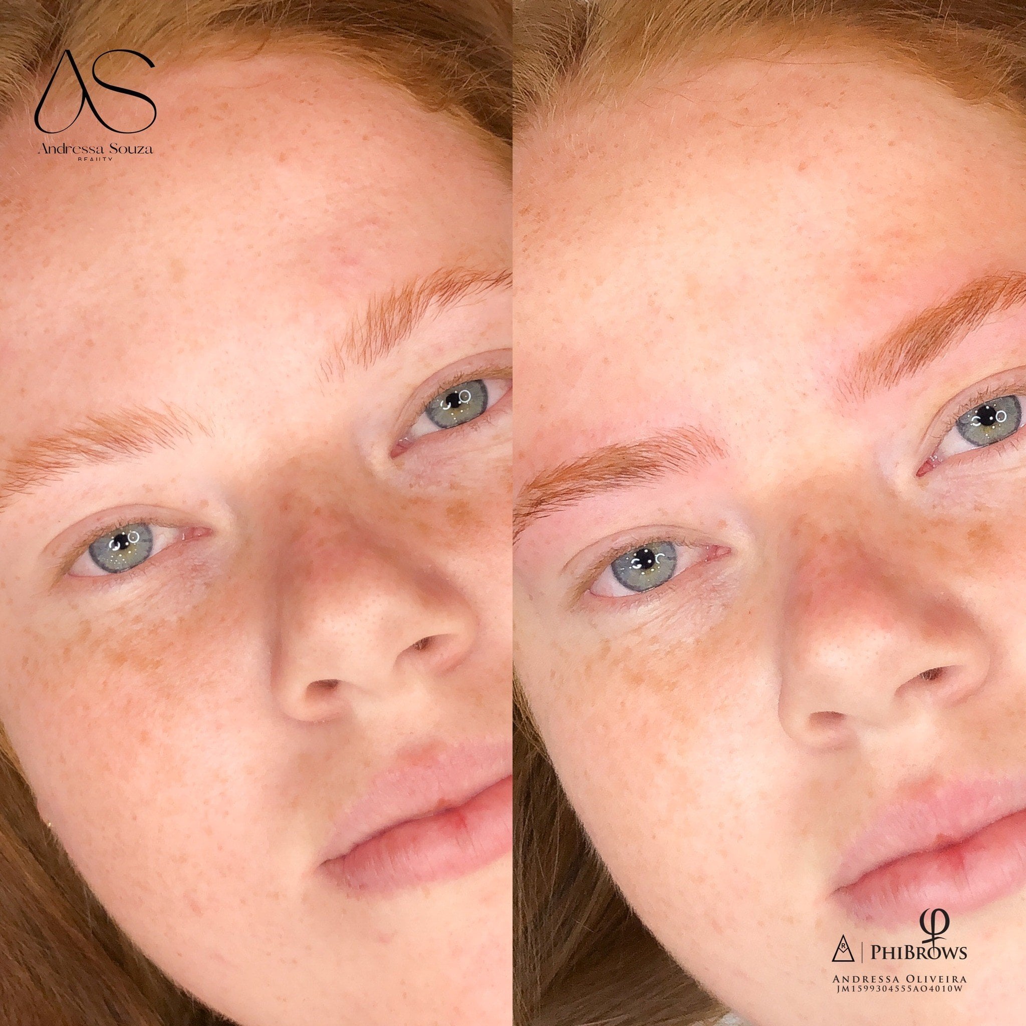 Antes e depois de NanoBlading em cliente ruiva