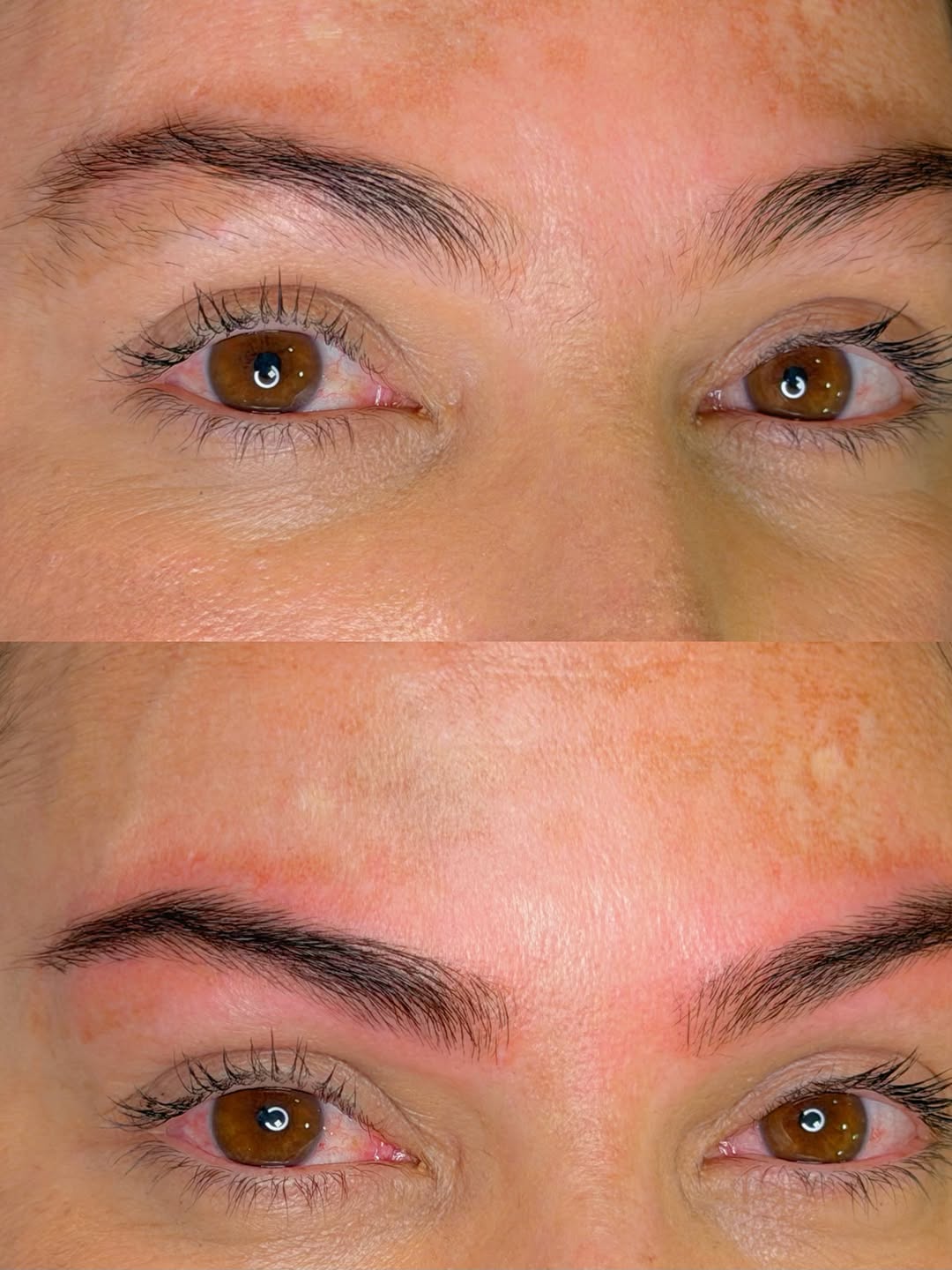 Antes e depois de preenchimento de falhas nas sobrancelhas